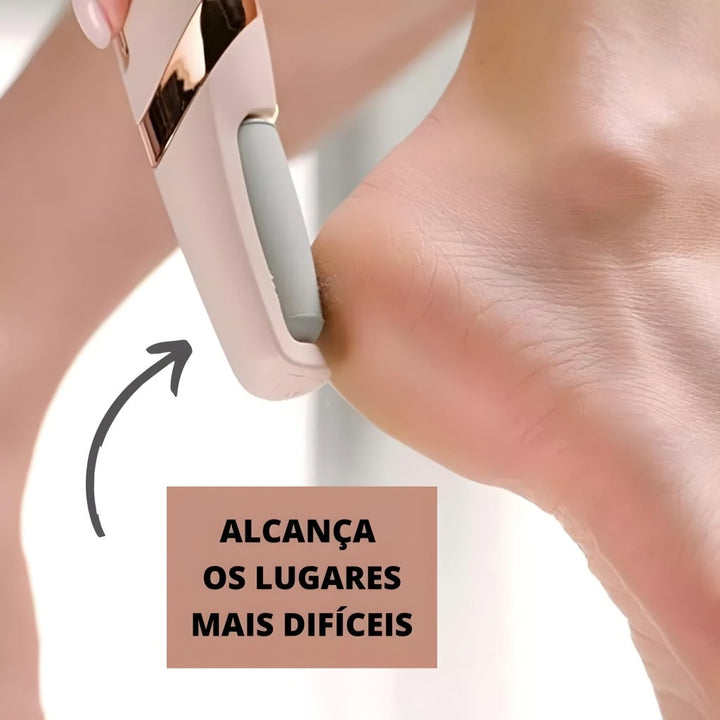 Lixa Elétrica Removedor De Calos Recarregável Inova Prime